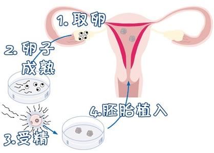 液氮储存